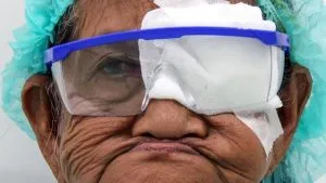 Cara Mengatasi Katarak…